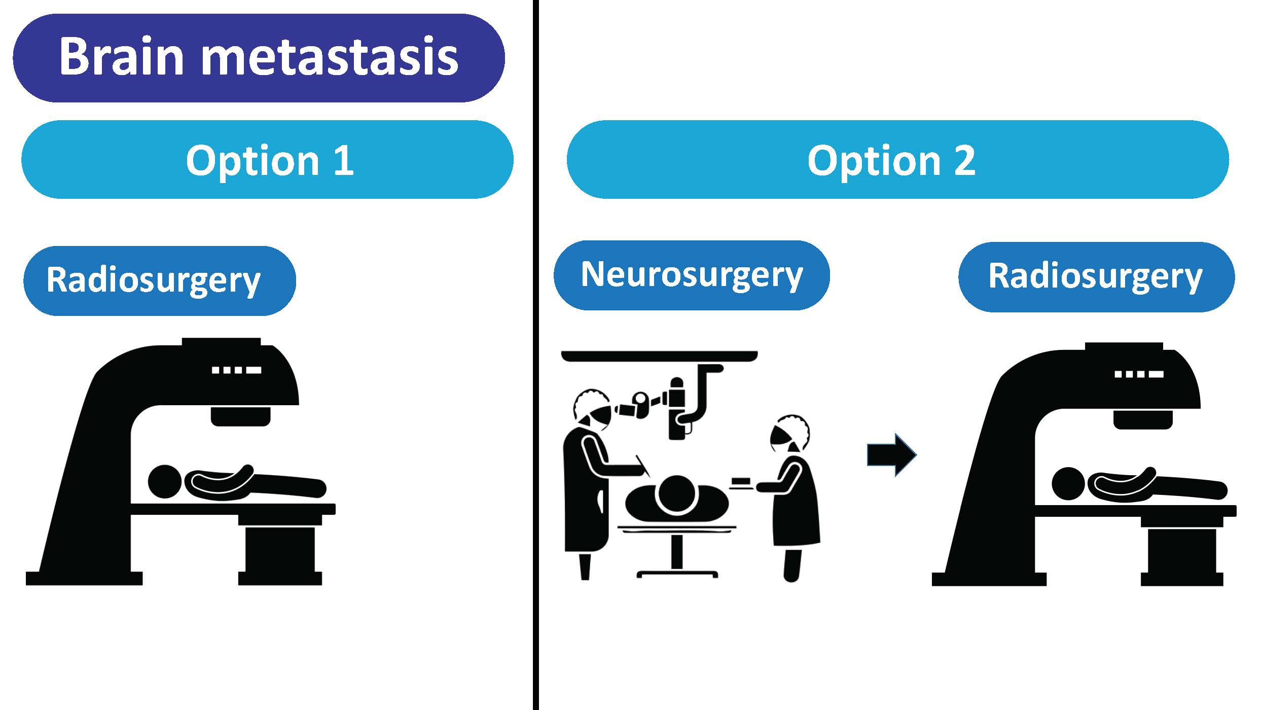 Option one radiosurgery alone or option two neuro surgery followed by radio surgery.