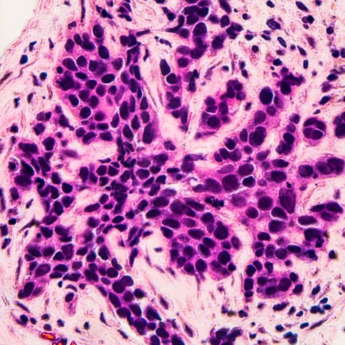 breast scan close up