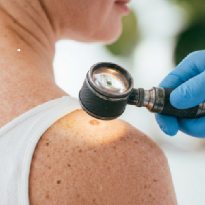 Skin check using dermascope - canva